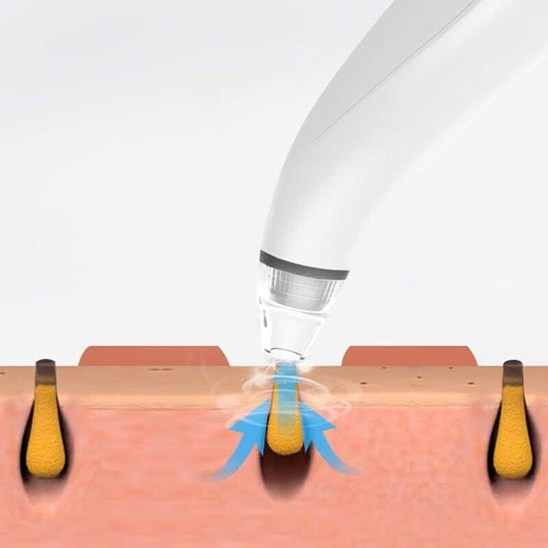Professional Electric Blackhead Remover with Diamond Pore Vacuum Suction for Facial Cleansing